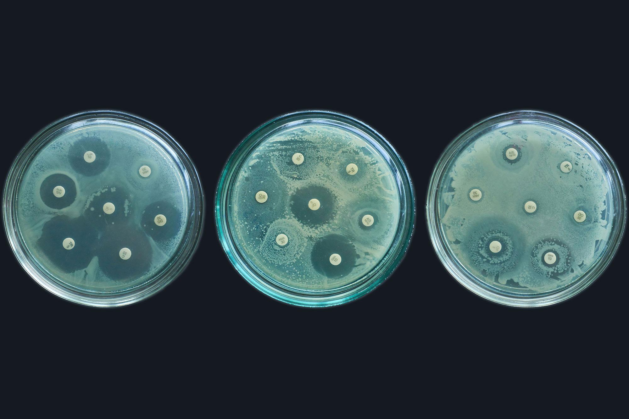 Picture of petri dishes